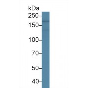 Western blot analysis of Rat Heart lysate, using Human NES Antibody (2 µg/ml) and HRP-conjugated Goat Anti-Mouse antibody (<a href="https://www.abbexa.com/index.php?route=product/search&amp;search=abx400001" target="_blank">abx400001</a>, 0.2 µg/ml).