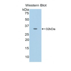 Nestin (NES) Antibody