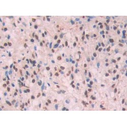 Amyloid beta 42 (Abeta42) Antibody