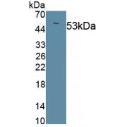 Procollagen III N-Terminal Propeptide (PIIINP) Antibody