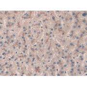 IHC-P analysis of formalin fixed paraffin embedded kidney tissue, with DAB staining.