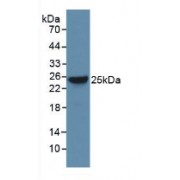 Western blot analysis of recombinant Rat Bax.