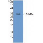 Western blot analysis of recombinant Mouse PLCe1.