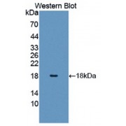Western blot analysis of recombinant Human H3.