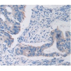 Transferrin Receptor Protein 1 / CD71 (TFRC) Antibody