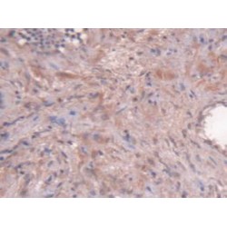 Hepatitis A Virus Cellular Receptor 1 (HAVCR1) Antibody