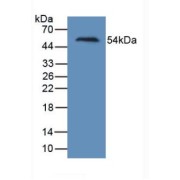 Western blot analysis of recombinant Human Kim1.