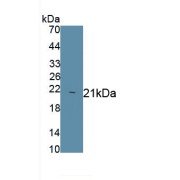 Western blot analysis of Human recombinant HP protein.