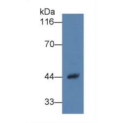 Haptoglobin Beta Chain (HP) Antibody