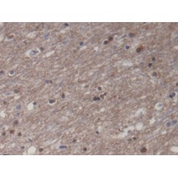 Creatine Kinase, Muscle (CKM) Antibody