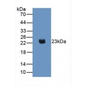 Western blot analysis of recombinant Mouse IL2.