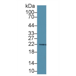 N-Terminal Pro-Brain Natriuretic Peptide (NT-ProBNP) Antibody