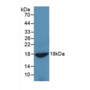 Western blot analysis of recombinant Rat ADP.