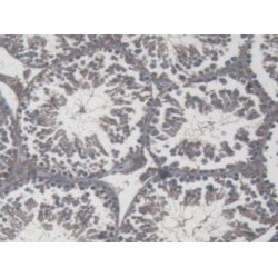 Interferon Gamma (IFNg) Antibody