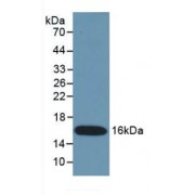 Western blot analysis of recombinant Mouse IFNg.