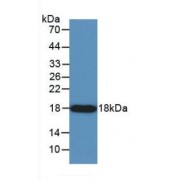 Western blot analysis of recombinant Human ANG, Human.