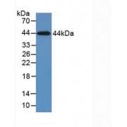 Western blot analysis of recombinant Human KRT5.