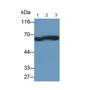 Western blot analysis of Human lung tissue (Lane 1), A549 (Lane 2), HepG2 (Lane 3) cell lysates using Histone Deacetylase 1 (HDAC1) Antibody (0.2 µg/ml) and HRP-conjugated Goat Anti-Mouse antibody (<a href="https://www.abbexa.com/index.php?route=product/search&amp;search=abx400001" target="_blank">abx400001</a>, 0.2 µg/ml).