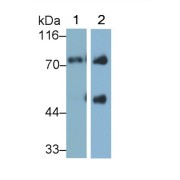 Western blot analysis of Rat serum (Lane 1) and plasma (Lane 2) using Afamin (AFM) Antibody (0.5 µg/ml) and HRP-conjugated Goat Anti-Mouse antibody (<a href="https://www.abbexa.com/index.php?route=product/search&amp;search=abx400001" target="_blank">abx400001</a>, 0.2 µg/ml).