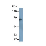 Western blot analysis of Rat liver tissue using Catalase (CAT) Antibody (0.2 µg/ml) and and HRP-conjugated Goat Anti-Mouse antibody (<a href="https://www.abbexa.com/index.php?route=product/search&amp;search=abx400001" target="_blank">abx400001</a>, 0.2 µg/ml).