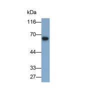 Western blot analysis of Rat liver tissue using Catalase (CAT) Antibody (0.2 µg/ml) and and HRP-conjugated Goat Anti-Mouse antibody (<a href="https://www.abbexa.com/index.php?route=product/search&amp;search=abx400001" target="_blank">abx400001</a>, 0.2 µg/ml).