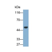 Western blot analysis of Human Plasma using Beta-2-Microglobulin (b2M) Antibody (0.1 µg/ml) and HRP-conjugated Goat Anti-Mouse antibody (<a href="https://www.abbexa.com/index.php?route=product/search&amp;search=abx400001" target="_blank">abx400001</a>, 0.2 µg/ml).