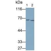 Western blot analysis of (1) THP1 cell lysates, and (2) HepG2 cell lysates, using Rabbit Anti-Human ABCD3 Antibody (0.1 µg/ml) and HRP-conjugated Goat Anti-Rabbit antibody (<a href="https://www.abbexa.com/index.php?route=product/search&amp;search=abx400043" target="_blank">abx400043</a>, 0.2 µg/ml).