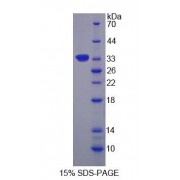 SDS-PAGE analysis of Ribosomal Protein S6 Kinase alpha 1 Protein.