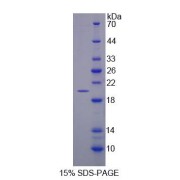 SDS-PAGE analysis of GA Binding Protein Transcription Factor alpha Protein.