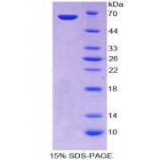 SDS-PAGE analysis of Centromere Protein I Protein.