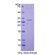 SDS-PAGE analysis of Centromere Protein H Protein.