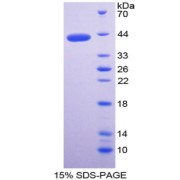 SDS-PAGE analysis of Matrix Gla Protein.