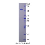 SDS-PAGE analysis of recombinant Human Translocator Protein.