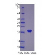 SDS-PAGE analysis of Coactosin Like Protein 1 Protein.
