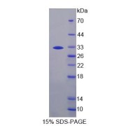 SDS-PAGE analysis of Pregnancy Zone Protein.