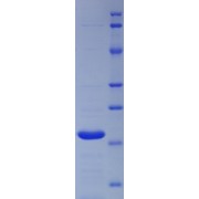 SDS-PAGE analysis of Heat Shock 60kD Protein 1, Chaperonin Protein.