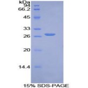SDS-PAGE analysis of Axis Inhibition Protein.