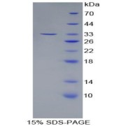 SDS-PAGE analysis of ANGPTL3 Protein.