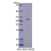 SDS-PAGE analysis of Lymphocyte Adaptor Protein.