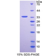 SDS-PAGE analysis of High Mobility Group Protein 2 Like Protein 1 Protein.