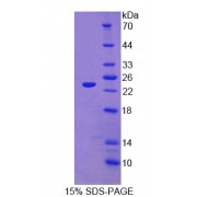 SDS-PAGE analysis of Twisted Gastrulation Protein Homolog 1 Protein.