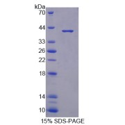 SDS-PAGE analysis of recombinant Mouse S100A10 Protein.