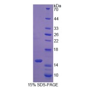 SDS-PAGE analysis of S100A16 Protein.