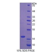 SDS-PAGE analysis of S100A9 Protein.