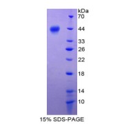 SDS-PAGE analysis of S100A2 Protein.