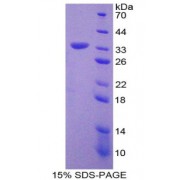 SDS-PAGE analysis of C-C Motif Chemokine Ligand 7 Protein.