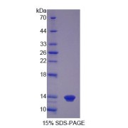 SDS-PAGE analysis of recombinant Pig S100A12 Protein.