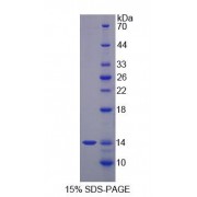 SDS-PAGE analysis of S100A12 Protein.