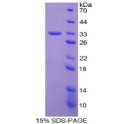 SDS-PAGE analysis of TEP1 Protein.