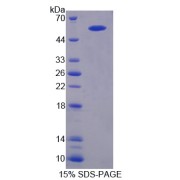 SDS-PAGE analysis of Amyloid beta Precursor Protein Binding B1 Interacting Protein.